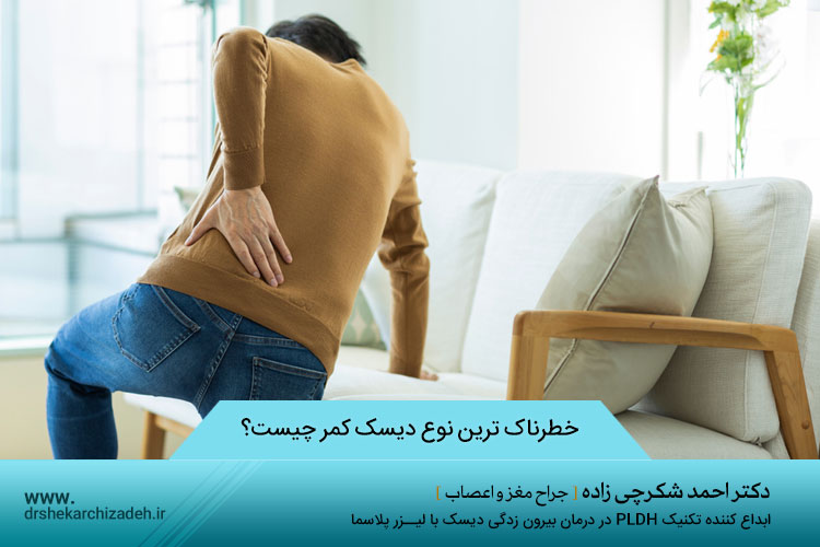 خطرناک ترین نوع دیسک کمر