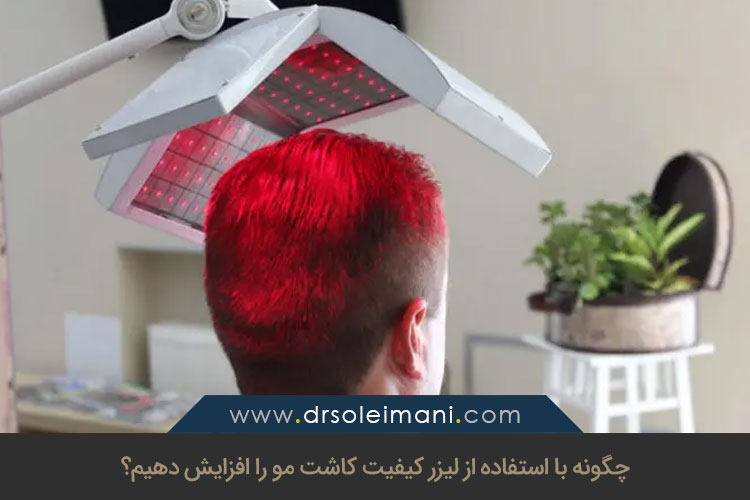 افزایش کیفیت کاشت موی طبیعی با استفاده از لیزر