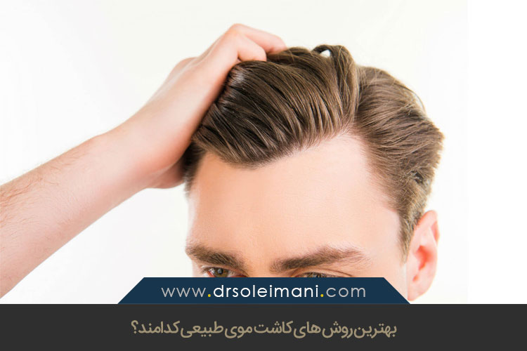 روش های کاشت موی طبیعی