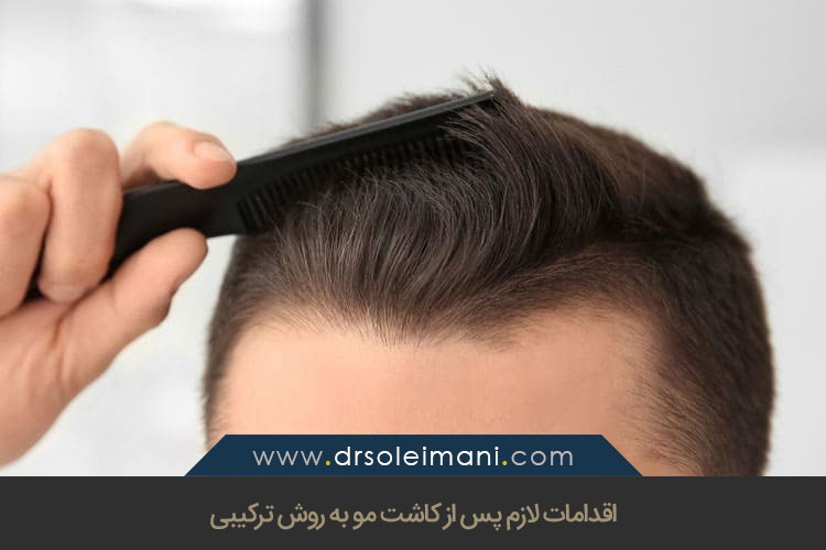 اقدامات لازم پس از کاشت مو به روش ترکیبی