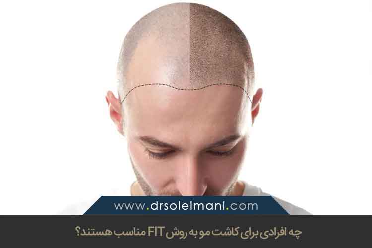 چه افرادی برای کاشت مو به روش FIT مناسب هستند؟