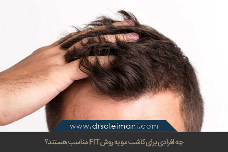 کاشت مو به روش FIT