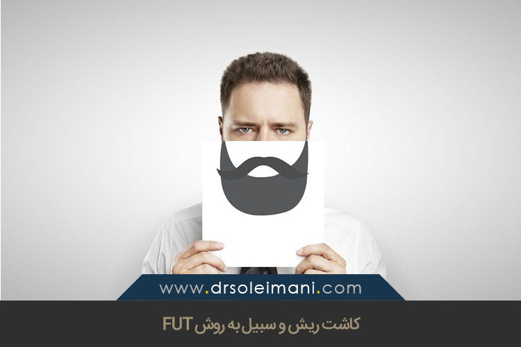 کاشت ریش و سبیل به روش FUT