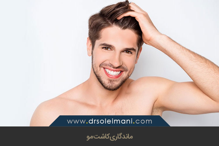 ماندگاری کاشت مو