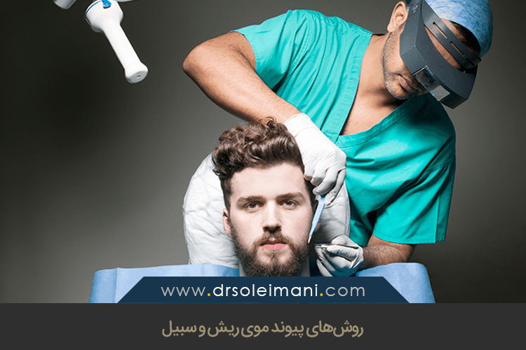 پیوند موی ریش و سبیل