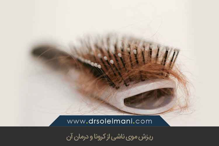 کرونا و ریزش مو