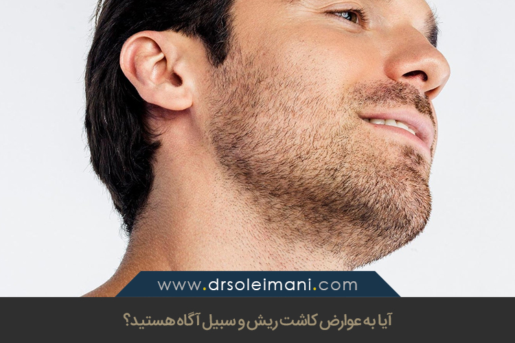 عوارض کاشت ریش و سبیل