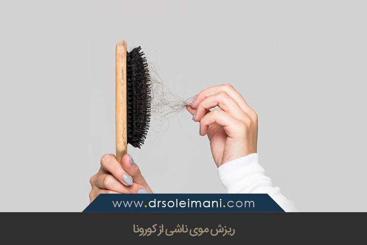 ریزش موی ناشی از کورونا