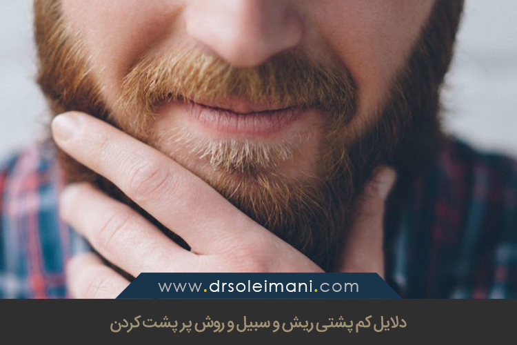 کم پشتی ریش