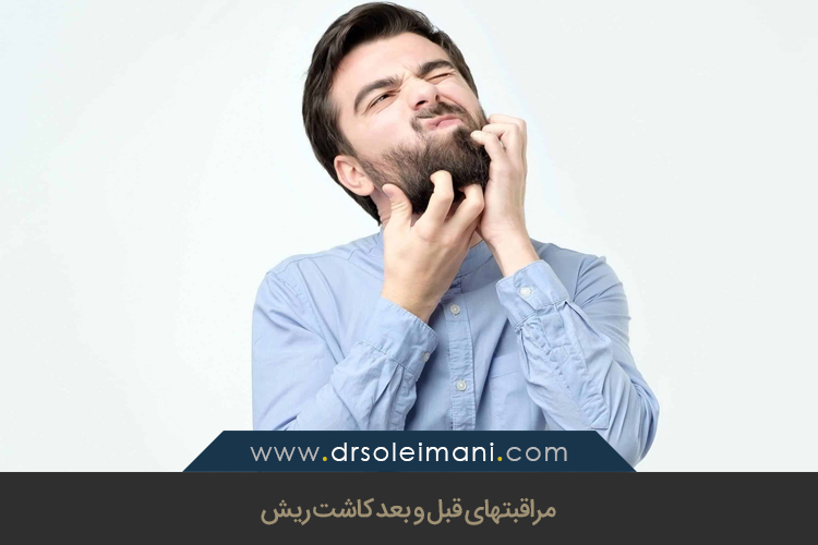 مراقبتهای قبل و بعد کاشت ریش