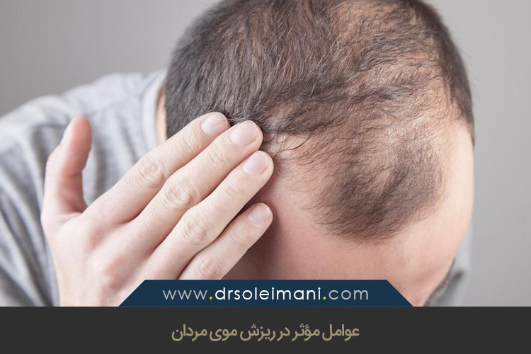 عوامل مؤثر در ریزش موی مردان