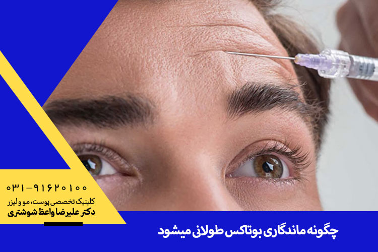 چگونه ماندگاری بوتاکس طولانی میشود؟