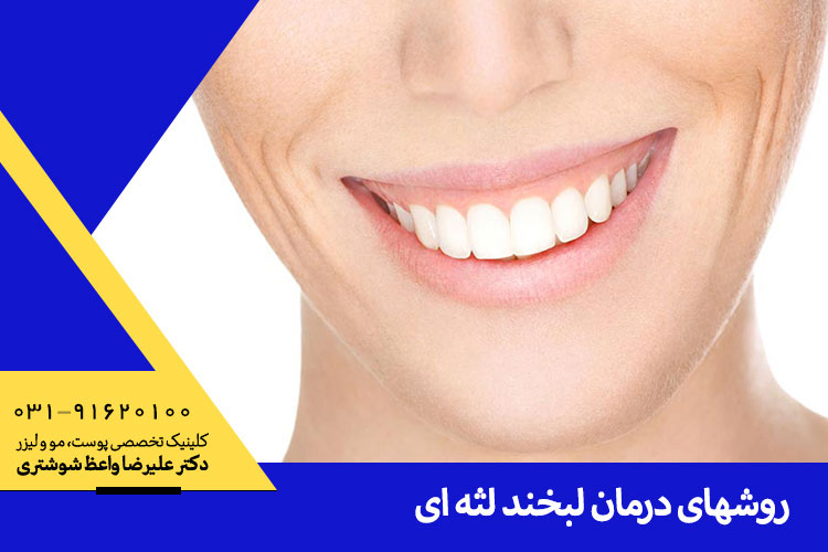 تزریق بوتاکس لبخند لثه ای در اصفهان