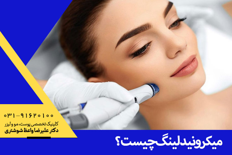 میکرونیدلینگ در اصفهان