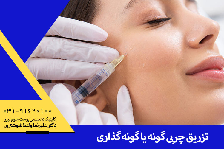 بهترین تزریق چربی گونه در اصفهان