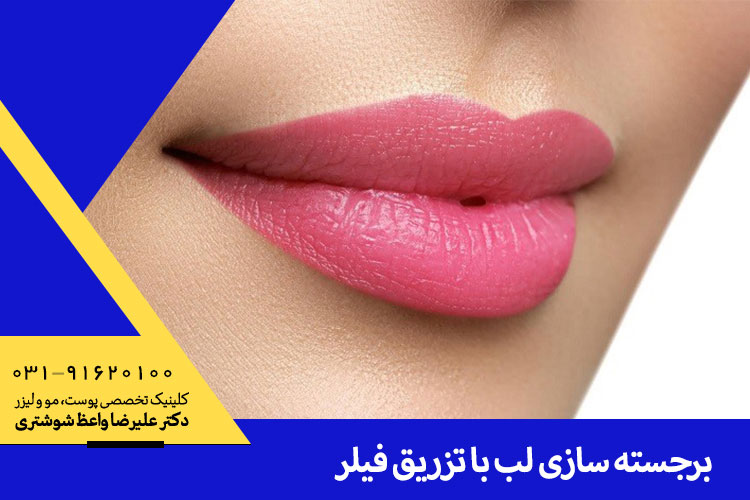 بهترین تزریق فیلر لب در اصفهان