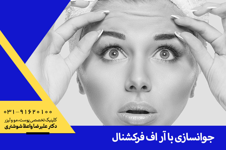 بهترین آر اف فرکشنال در اصفهان