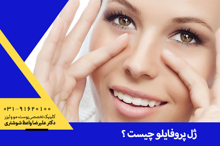 ژل پروفایلو در اصفهان