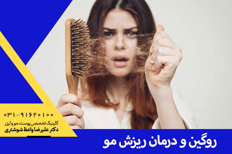 درمان ریزش مو با روگین