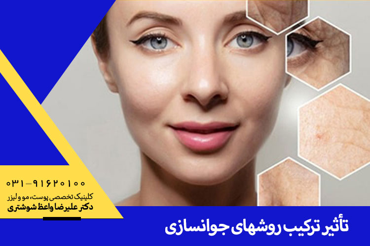 روش‌های جوانسازی در اصفهان