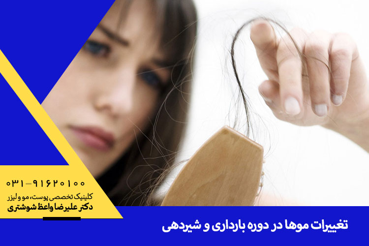 بررسی تغییرات مو در دوران بارداری و شیردهی