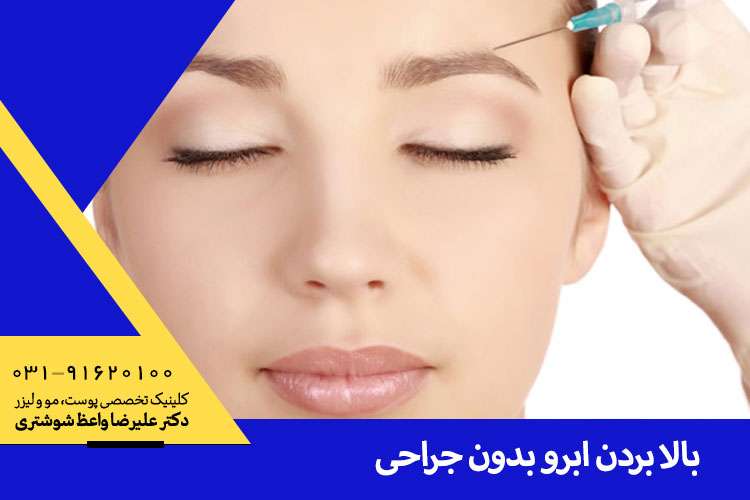 بهترین لیفت ابرو با تزریق ژل در اصفهان