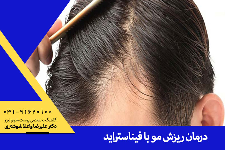 درمان ریزش مو در کلینیک دکتر علیرضا واعظ شوشتری