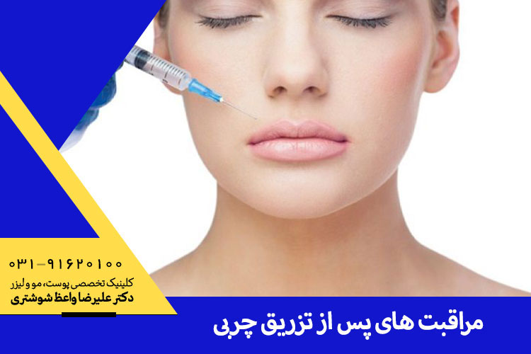 نکات بعد از تزریق چربی ، دکتر واعظ