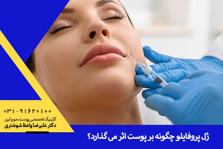 تزریق ژل پروفایلو ، دکتر علیرضا واعظ شوشتری