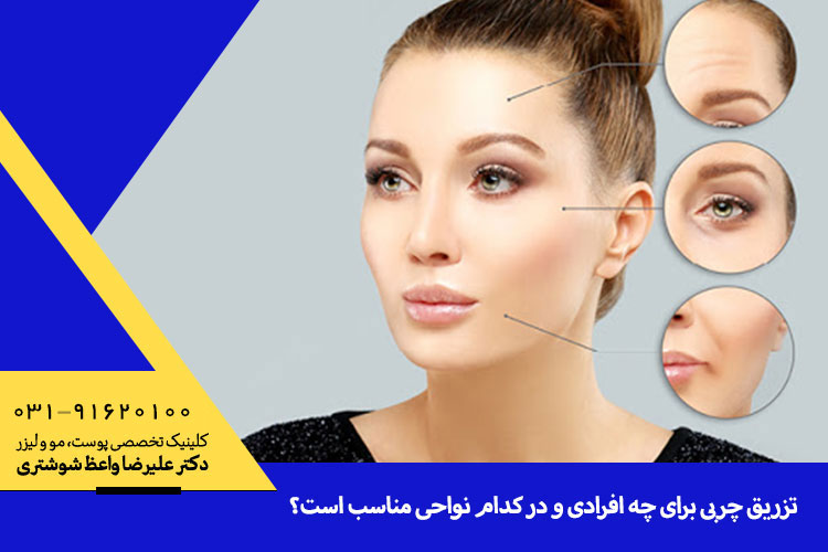 تزریق چربی برای چه افرادی و در کدام نواحی مناسب است