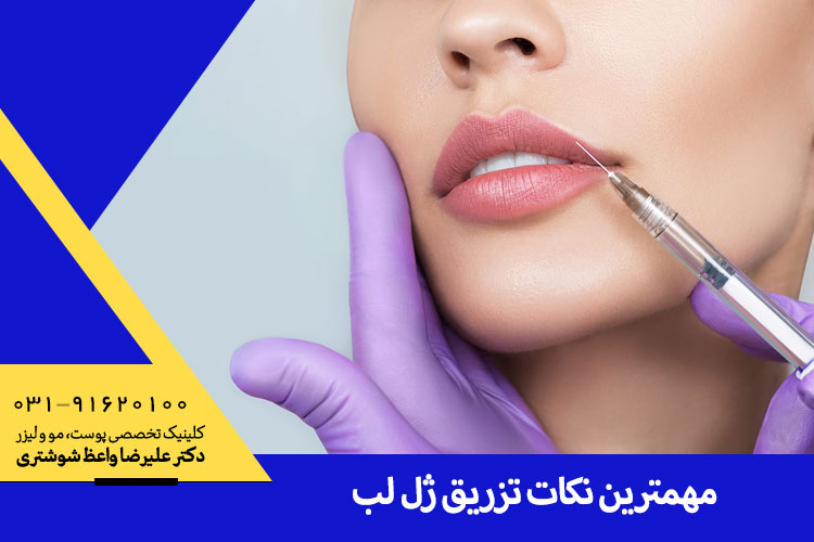 مهمترین نکات تزریق ژل لب