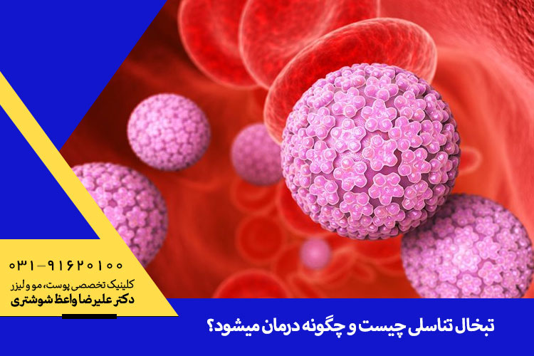 بهترین درمان تبخال تناسلی | متخصص پوست در اصفهان، دکتر علیرضا واعظ شوشتری