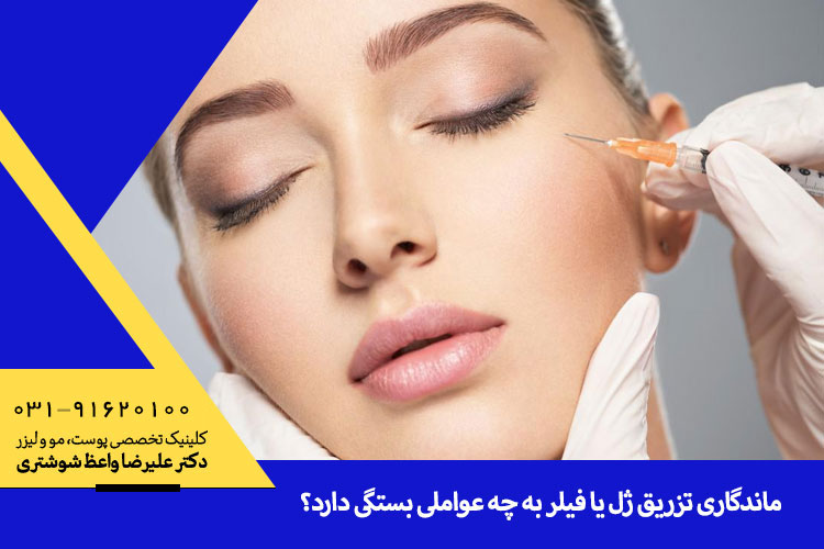 ماندگاری تزریق ژل | بهترین تزریق ژل در اصفهان