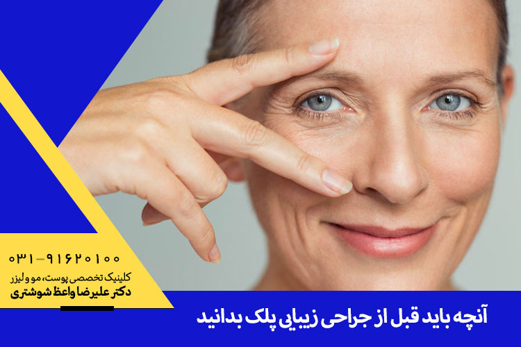 جراحی زیبایی پلک و دانستنیهای مربوط به آن | بهترین متخصص پوست اصفهان