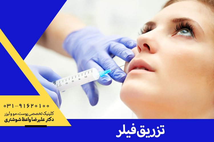 پس از تزریق فیلر منتظر چه نتایجی می‌توان بود؟