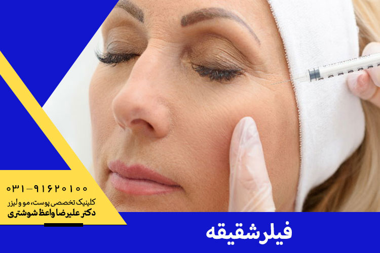 تزریق فیلر شقیقه در اصفهان | دکتر علیرضا واعظ شوشتری متخصص پوست و مو