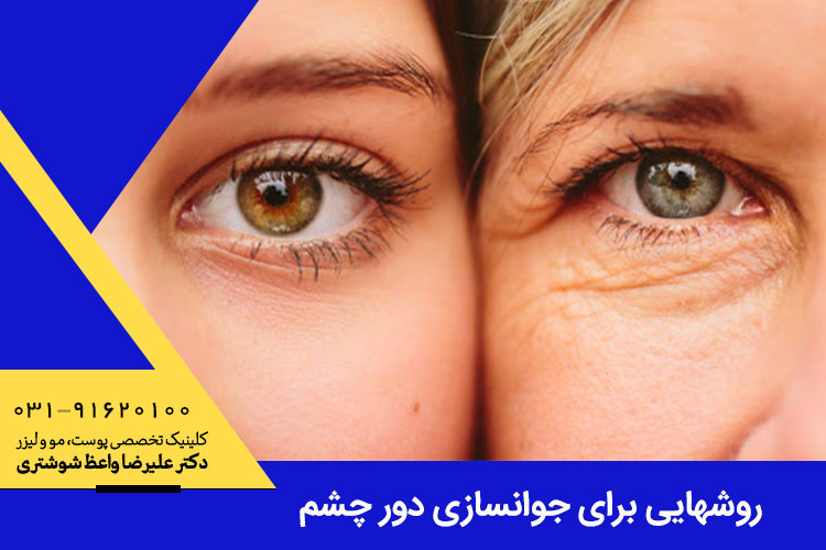 روش های جوانسازی دور چشم