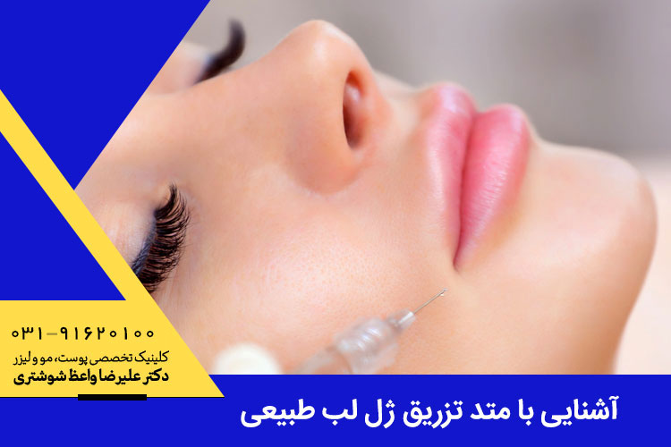 آشنایی با متد تزریق ژل لب طبیعی