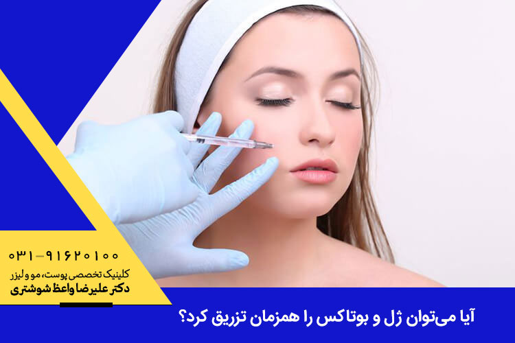 تزریق همزمان ژل و بوتاکس