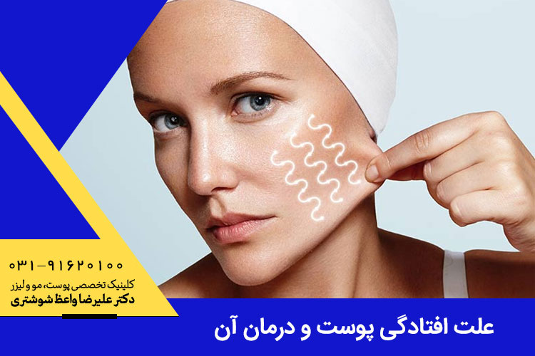 علت افتادگی پوست چیست و چگونه می‌توان آن را درمان کرد؟