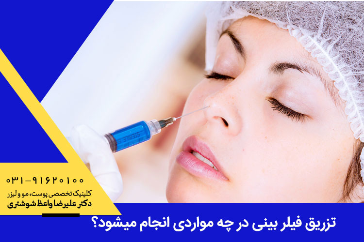 تزریق فیلر بینی