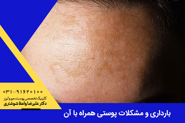 بارداری و مشکلات پوستی