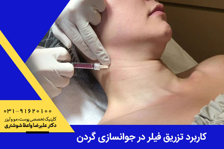 کاربرد تزریق فیلر در جوانسازی گردن