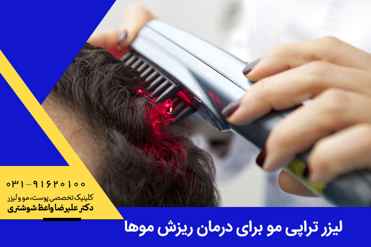 لیزر تراپی مو برای درمان ریزش موها	