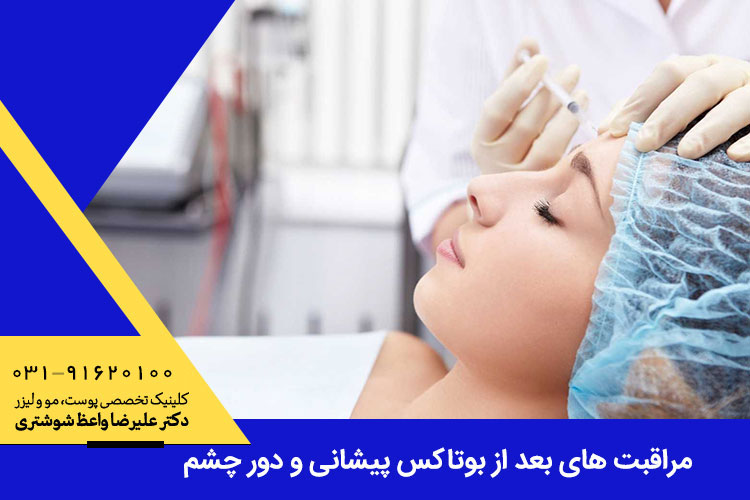 بوتاکس پیشانی و دور چشم