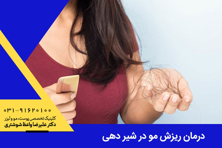 ریزش مو در شیردهی