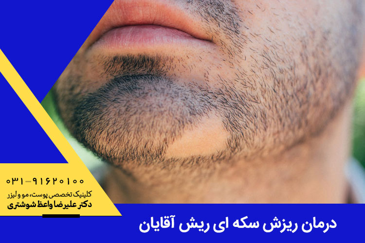 علت ریزش سکه ای ریش