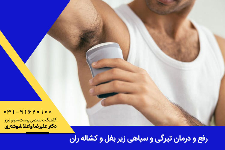 رفع و درمان تیرگی و سیاهی زیر بغل و کشاله ران