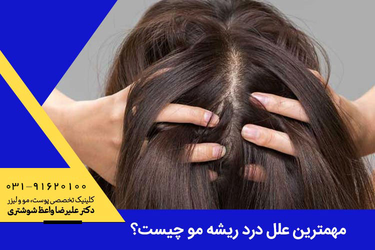 مهمترین علل درد ریشه مو