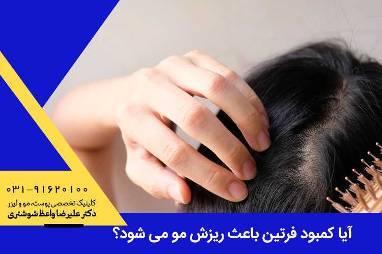 ریزش مو و کمبود فروتین